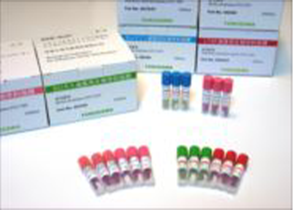 バイオロジカルインジケーター ACE test®エーステスト